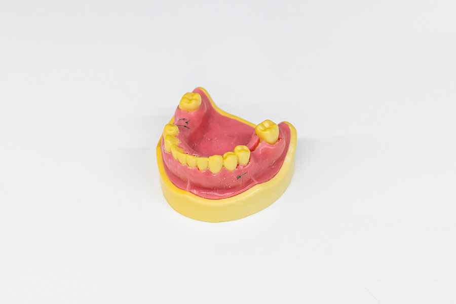 高齢でもインプラント治療は可能です