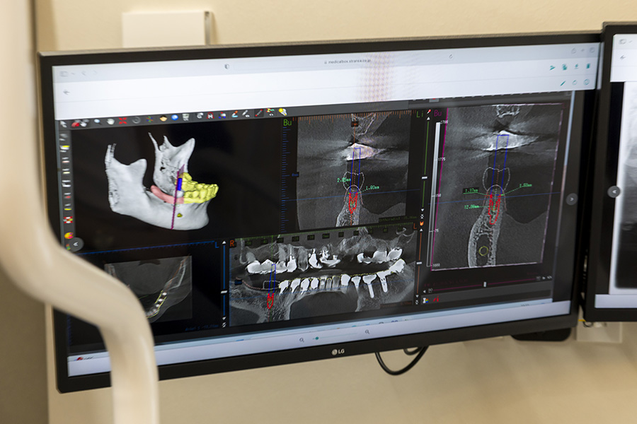 骨が少なくてもご安心ください。