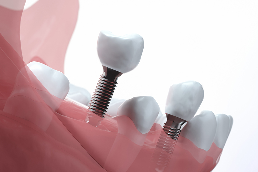 メンテナンスの重要性